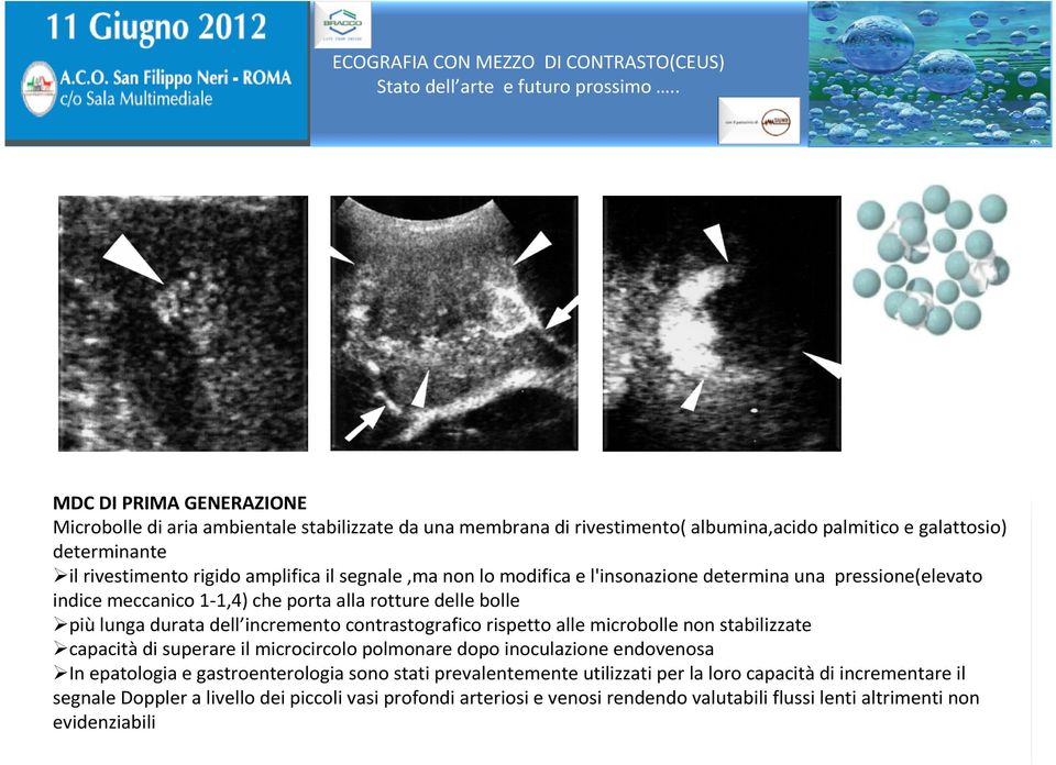 contrastografico rispetto alle microbolle non stabilizzate capacità di superare il microcircolo polmonare dopo inoculazione endovenosa In epatologia e gastroenterologia sono stati