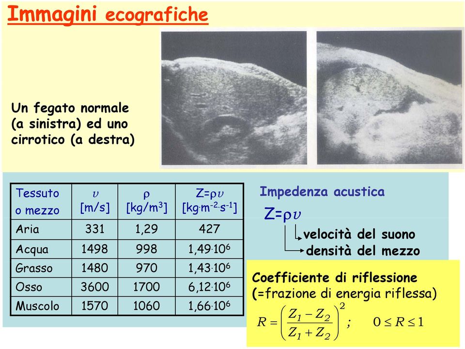 s -1 ] Impedenza acustica Z=ρv Aria 331 1,29 427 velocità del suono Acqua 1498 998 1,49.