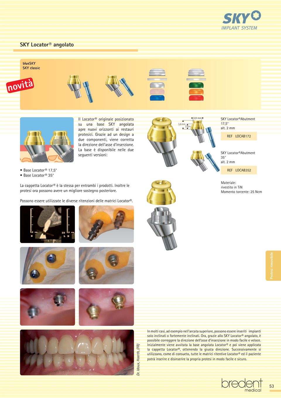 2 mm REF LOCAB172 SKY Locator Abutment 35 alt. 2 mm Base Locator 17,5 Base Locator 35 La cappetta Locator è la stessa per entrambi i prodotti.