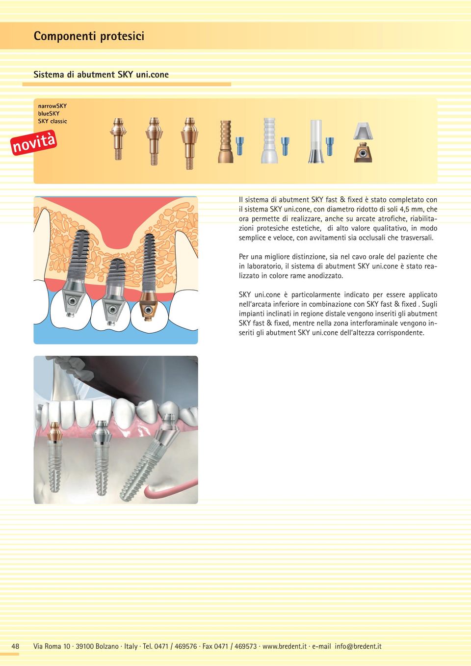 avvitamenti sia occlusali che trasversali. Per una migliore distinzione, sia nel cavo orale del paziente che in laboratorio, il sistema di abutment SKY uni.