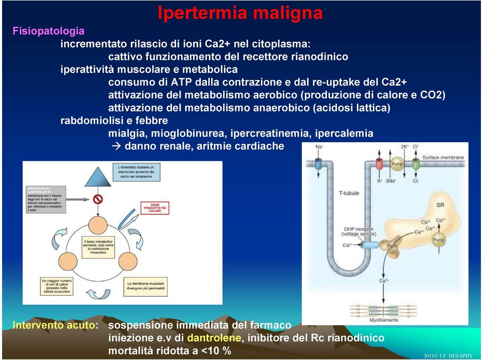 attivazione del metabolismo anaerobico (acidosi lattica) rabdomiolisi e febbre mialgia, mioglobinurea, ipercreatinemia, ipercalemia danno renale,