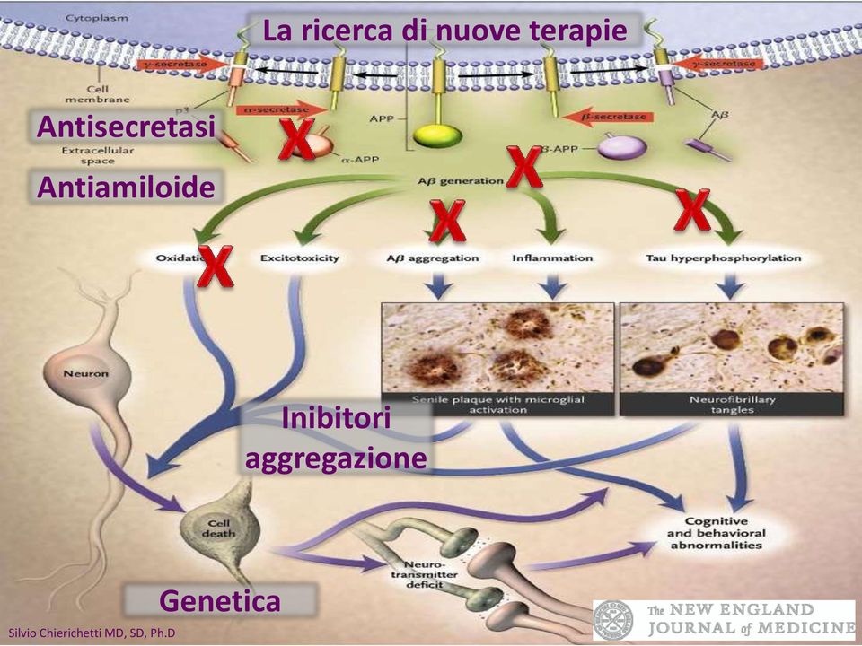 Antiamiloide