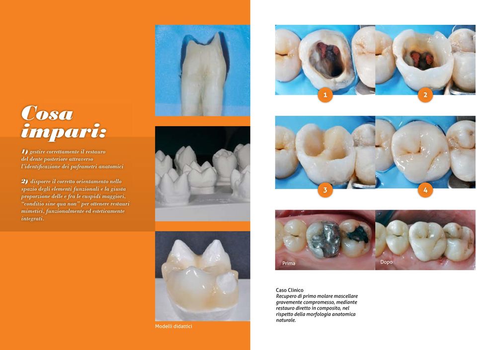 sine qua non per ottenere restauri mimetici, funzionalmente ed esteticamente integrati.