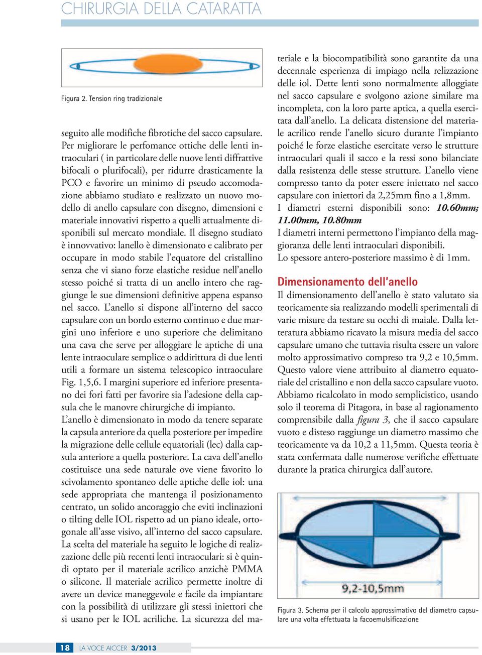 accomodazione abbiamo studiato e realizzato un nuovo modello di anello capsulare con disegno, dimensioni e materiale innovativi rispetto a quelli attualmente disponibili sul mercato mondiale.