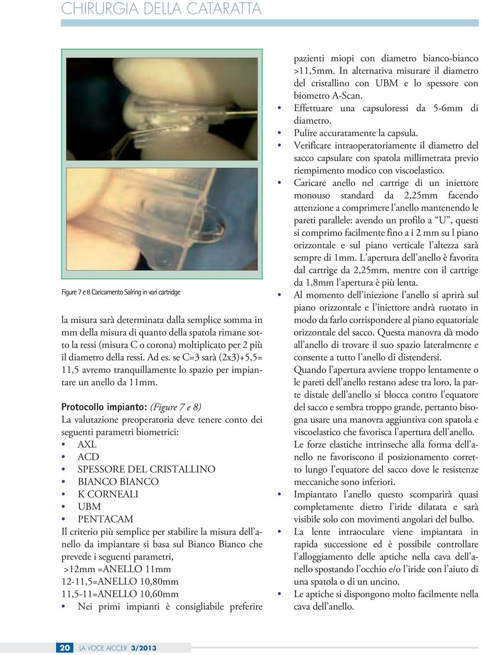 Protocollo impianto: (Figure 7 e 8) La valutazione preoperatoria deve tenere conto dei seguenti parametri biometrici: AXL ACD SPESSORE DEL CRISTALLINO BIANCO BIANCO K CORNEALI UBM PENTACAM Il