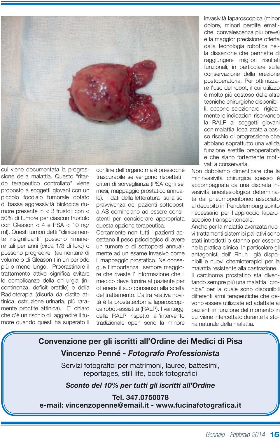 per ciascun frustolo con Gleason < 4 e PSA < 10 ng/ ml).