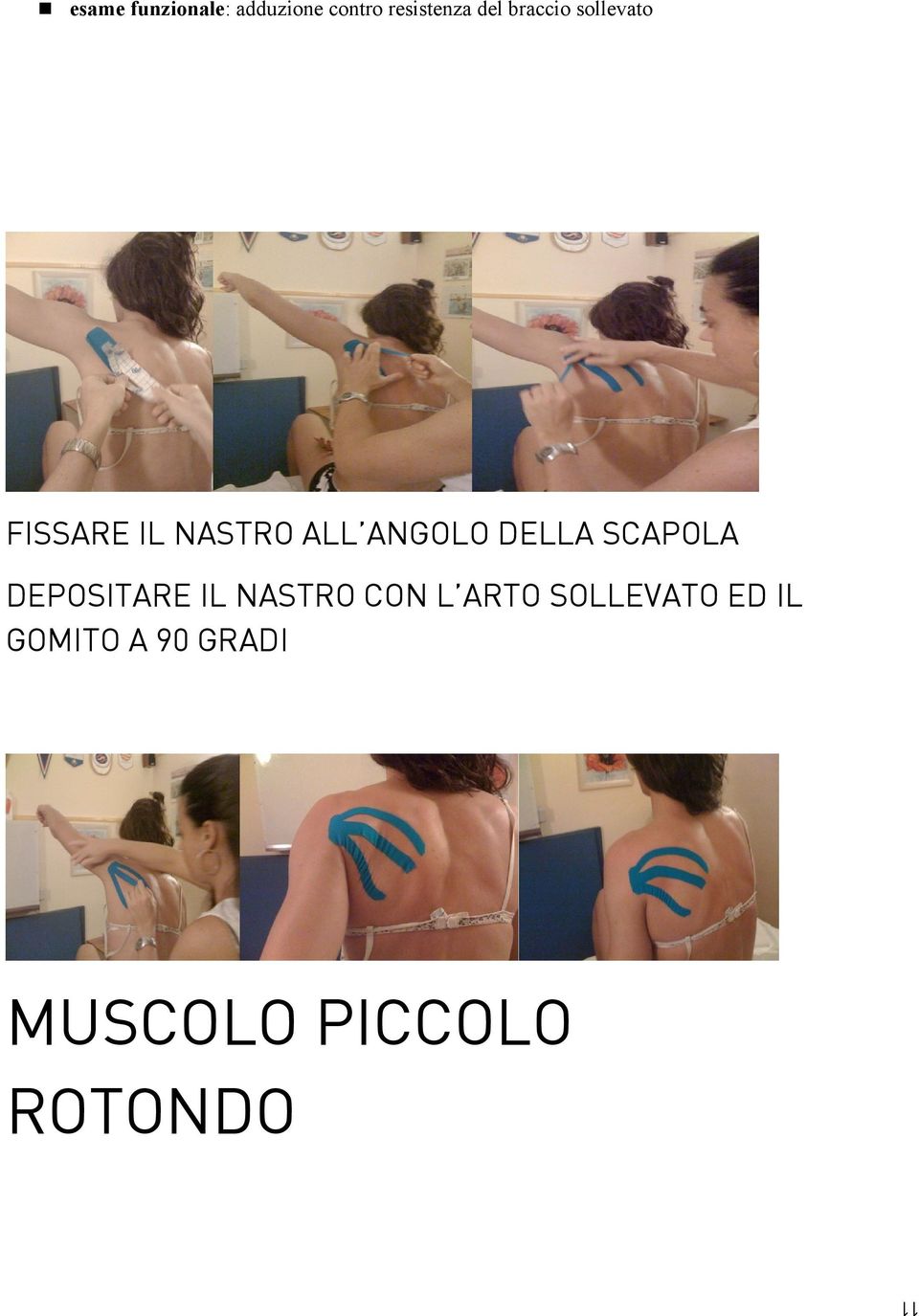 DELLA SCAPOLA DEPOSITARE IL NASTRO CON L ARTO