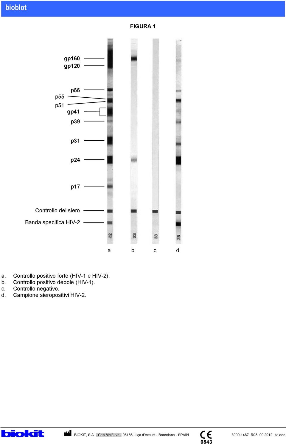 Controllo positivo forte (HIV-1 e HIV-2). b.