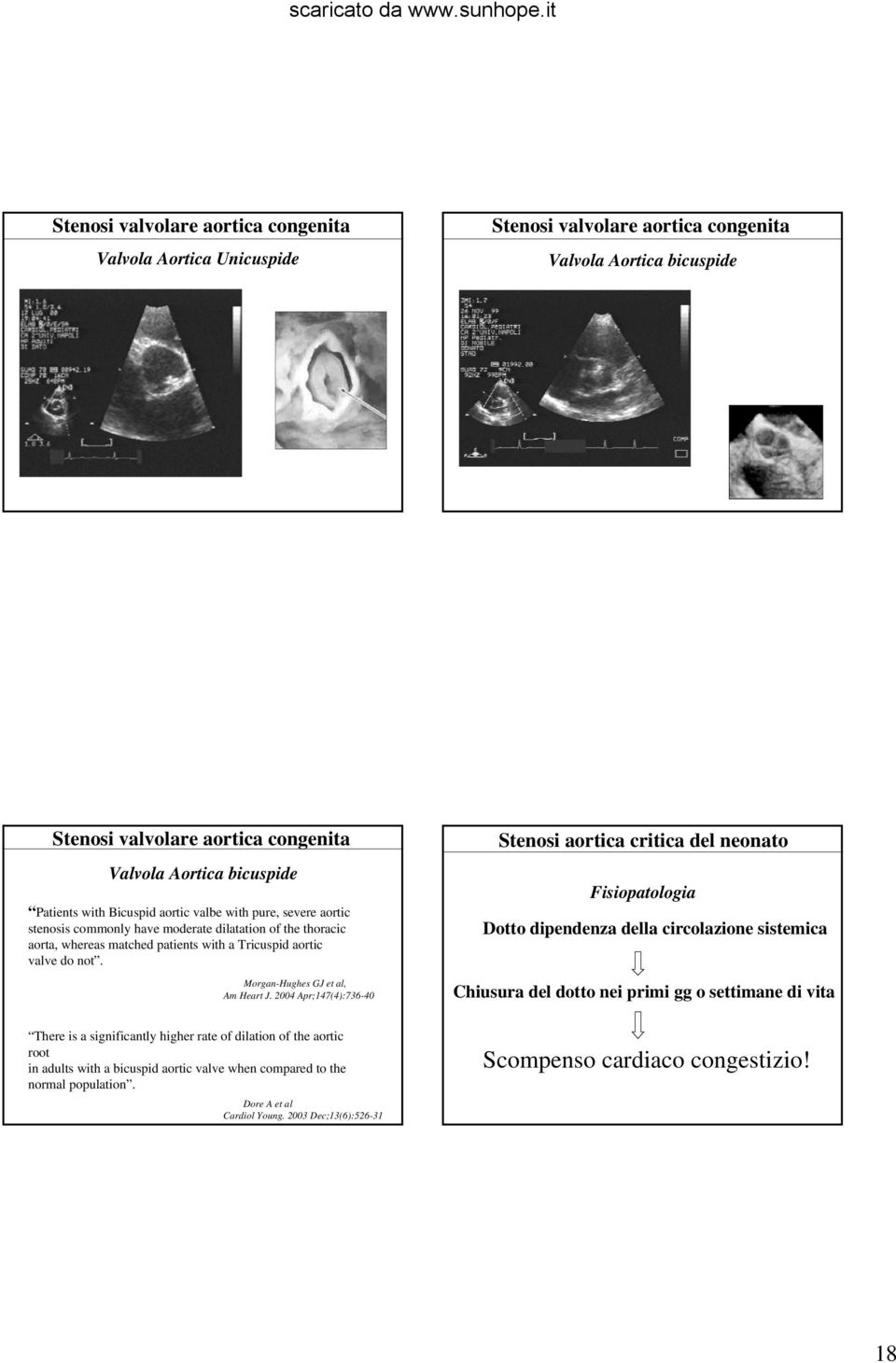 Morgan-Hughes GJ et al, Am Heart J.