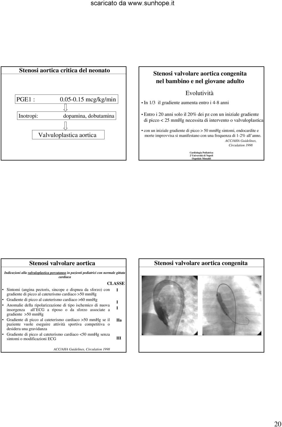 necessita di intervento o valvuloplastica con un iniziale gradiente di picco > 50 mmhg sintomi, endocardite e morte improvvisa si manifestano con una frequenza di 1-2% all anno.