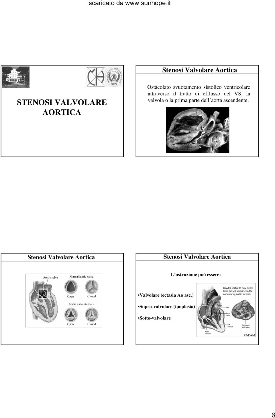 o la prima parte dell aorta ascendente.