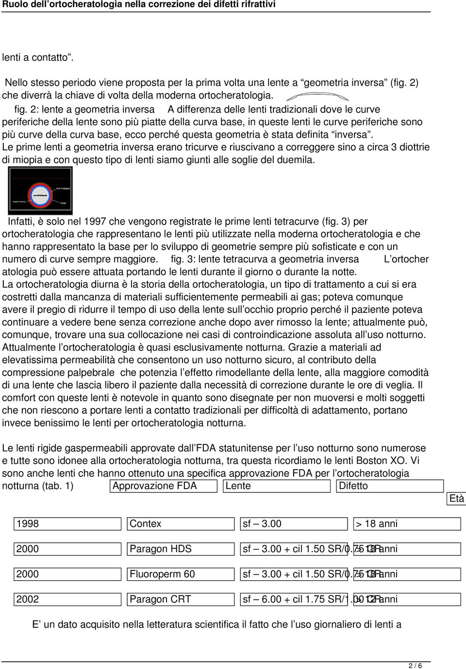 curva base, ecco perché questa geometria è stata definita inversa.