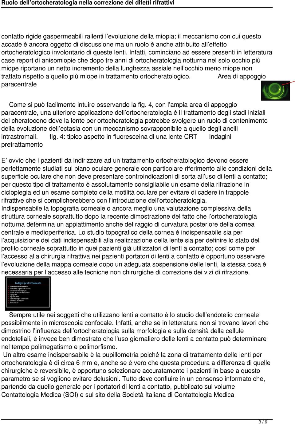 Infatti, cominciano ad essere presenti in letteratura case report di anisomiopie che dopo tre anni di ortocheratologia notturna nel solo occhio più miope riportano un netto incremento della lunghezza