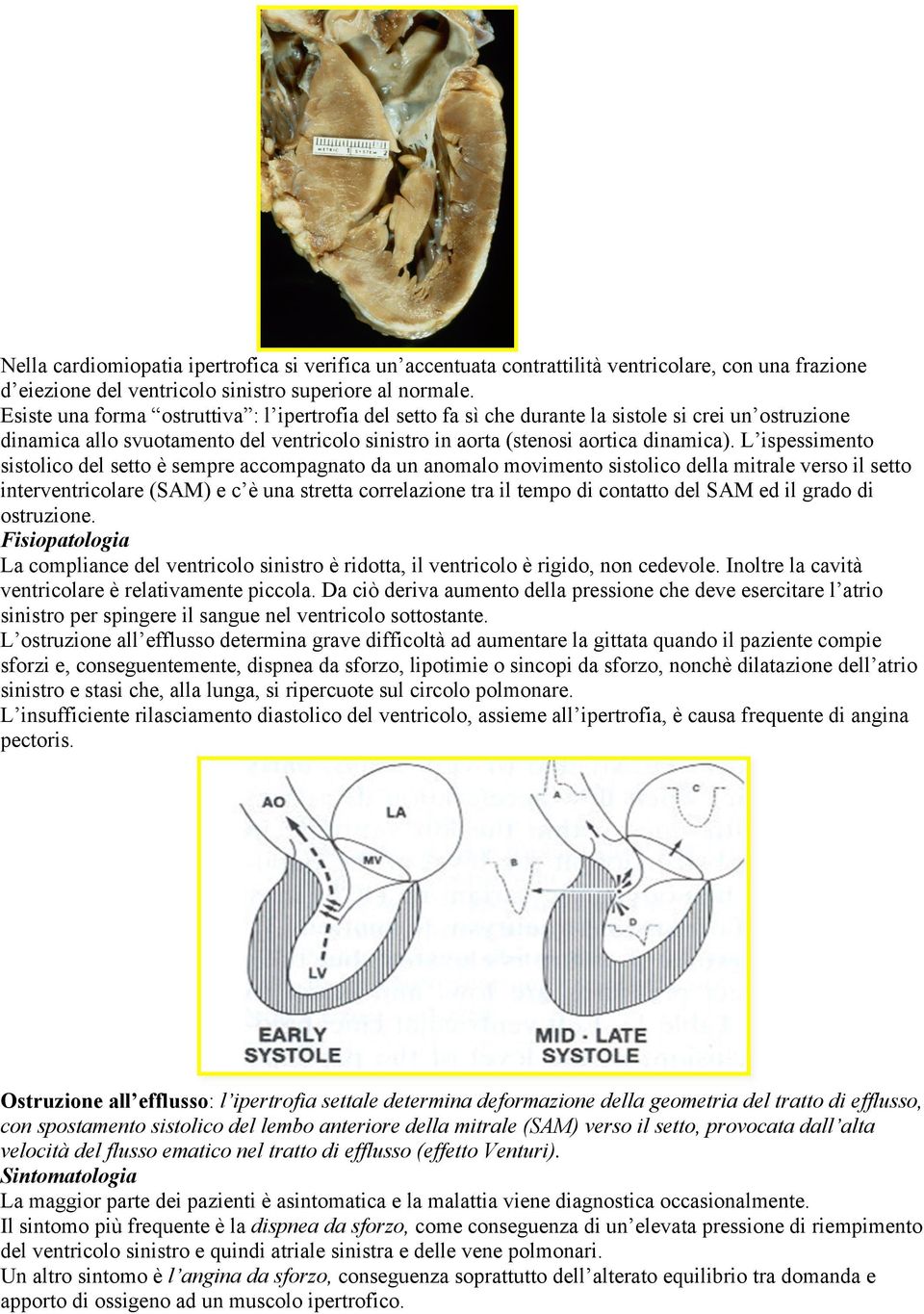 L ispessimento sistolico del setto è sempre accompagnato da un anomalo movimento sistolico della mitrale verso il setto interventricolare (SAM) e c è una stretta correlazione tra il tempo di contatto