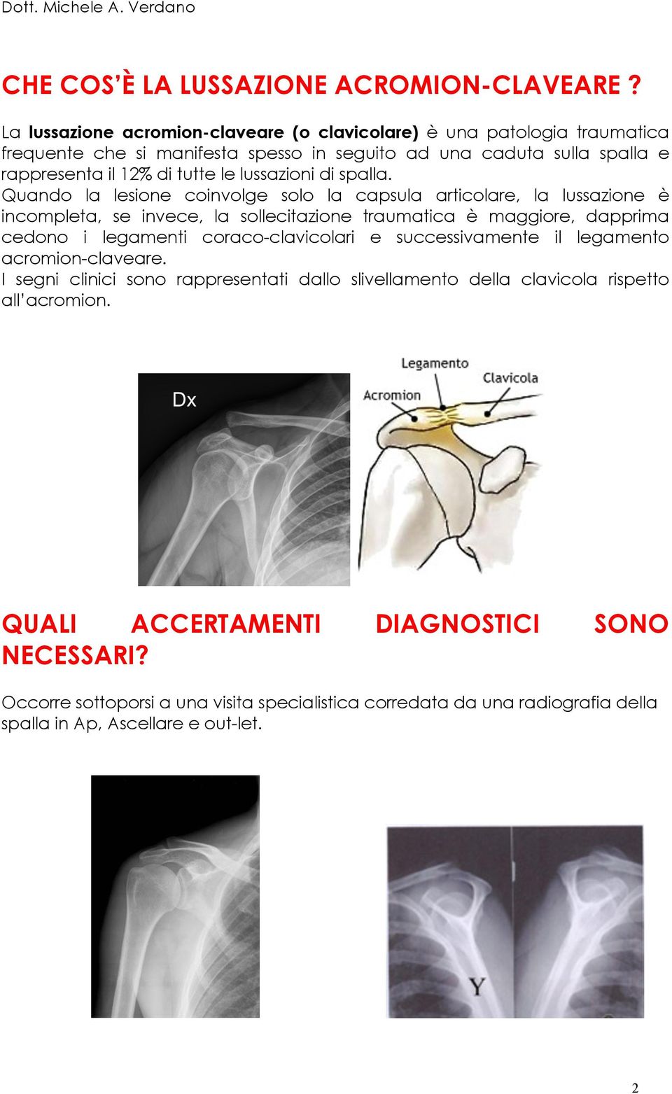 lussazioni di spalla.