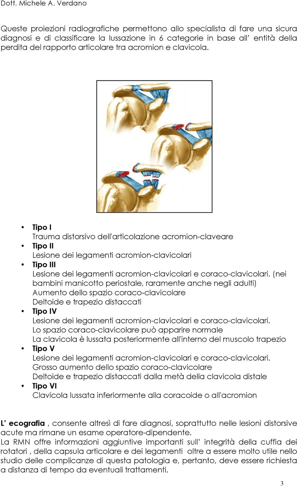 Tipo I Trauma distorsivo dell'articolazione acromion-claveare Tipo II Lesione dei legamenti acromion-clavicolari Tipo III Lesione dei legamenti acromion-clavicolari e coraco-clavicolari.