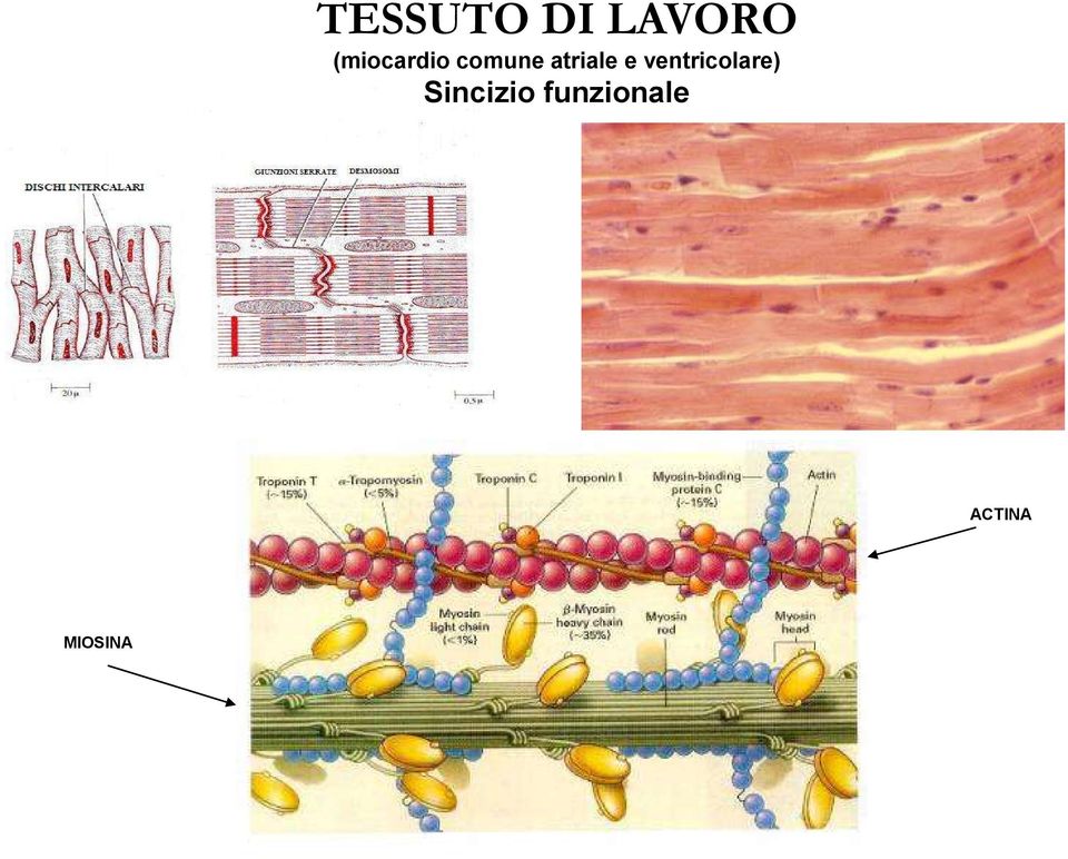 atriale e ventricolare)