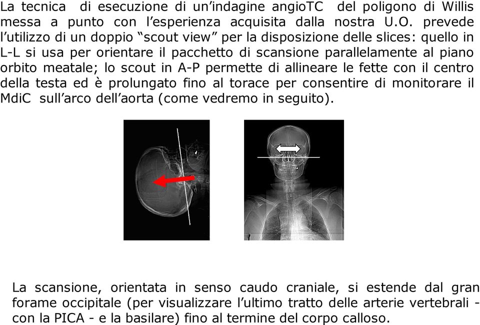 meatale; lo scout in A-P permette di allineare le fette con il centro della testa ed è prolungato fino al torace per consentire di monitorare il MdiC sull arco dell aorta (come