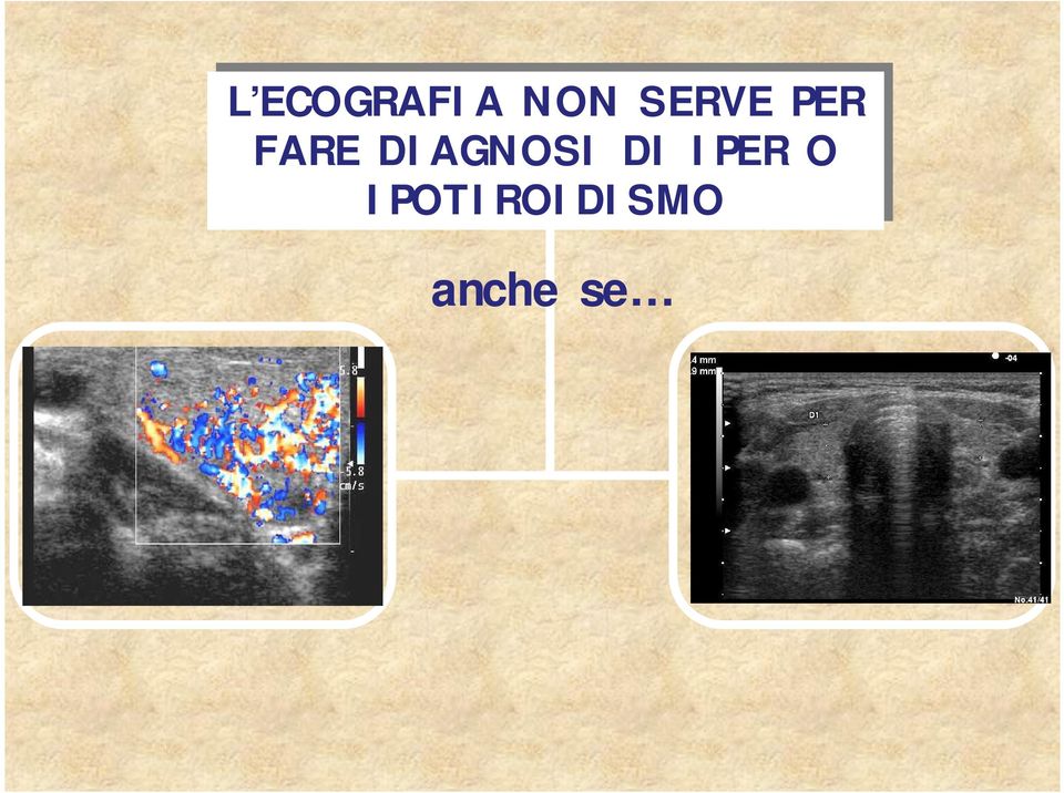 DIAGNOSI DI IPER