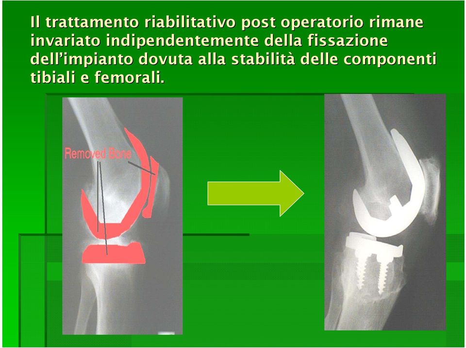 indipendentemente della fissazione dell