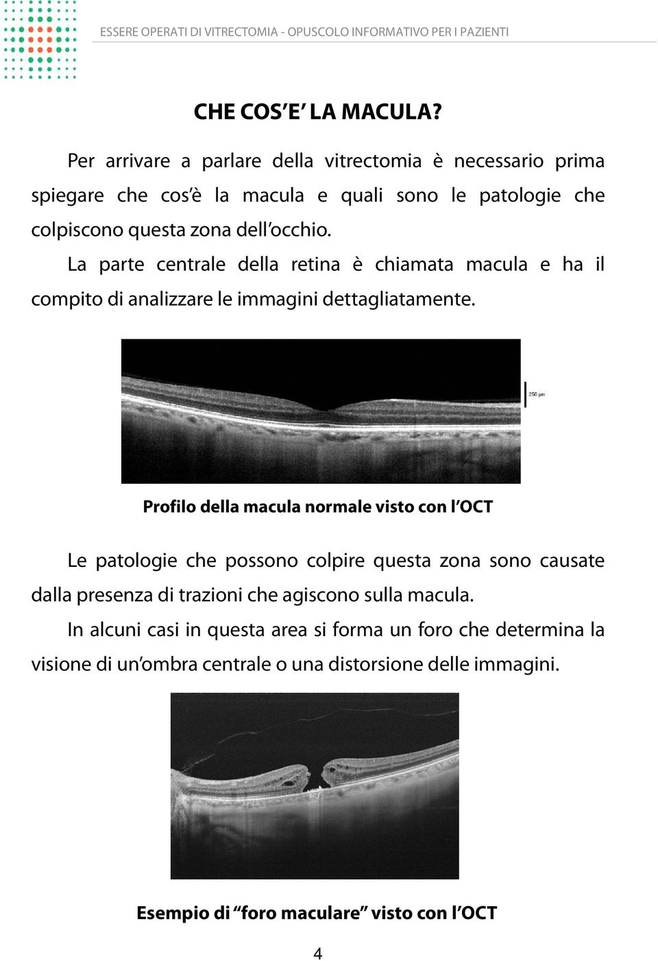 occhio. La parte centrale della retina è chiamata macula e ha il compito di analizzare le immagini dettagliatamente.