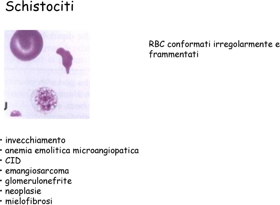 invecchiamento anemia emolitica