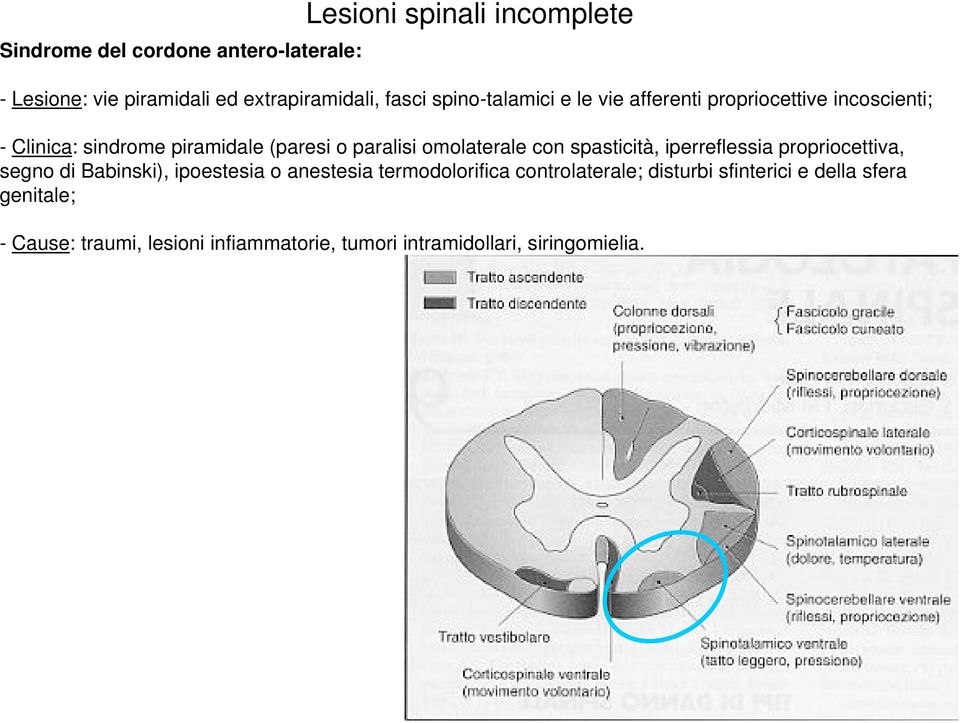 omolaterale con spasticità, iperreflessia propriocettiva, segno di Babinski), ipoestesia o anestesia termodolorifica