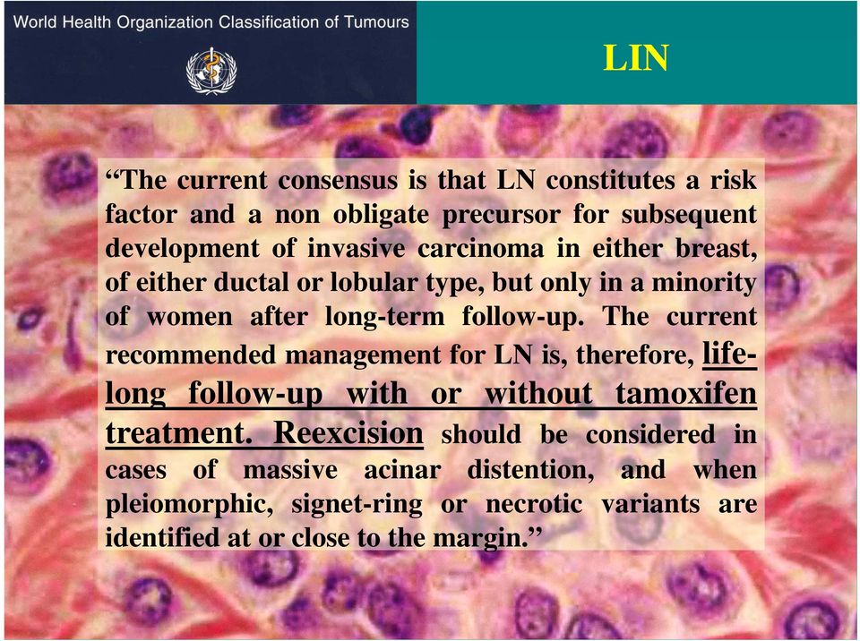 The current recommended management for LN is, therefore, lifelong follow-up with or without tamoxifen treatment.