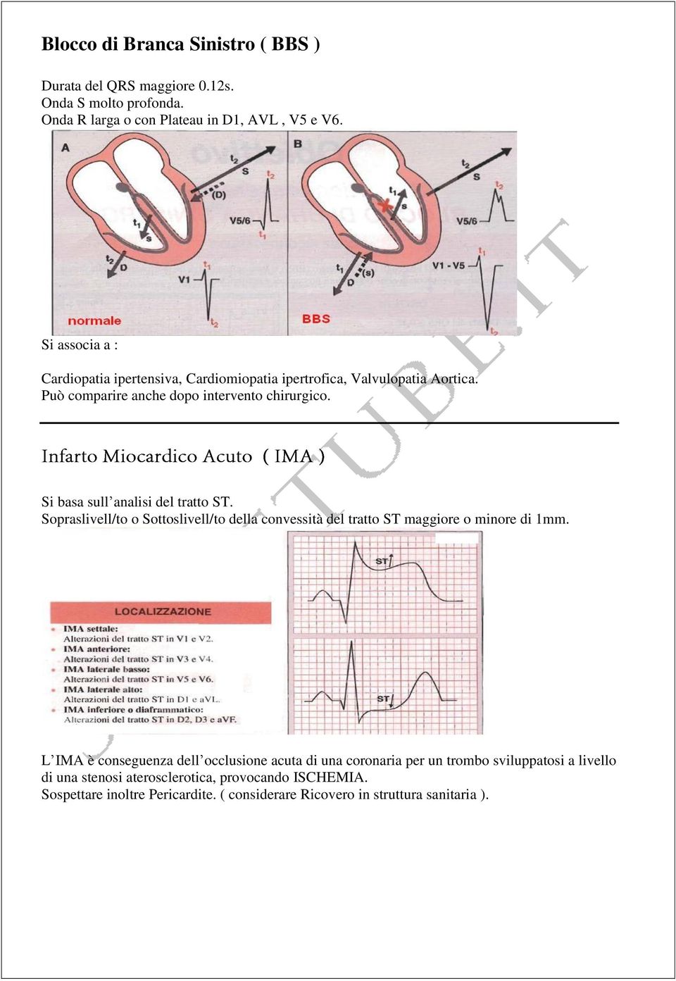 Si basa sull analisi del tratto ST. Sopraslivell/to o Sottoslivell/to della convessità del tratto ST maggiore o minore di 1mm.