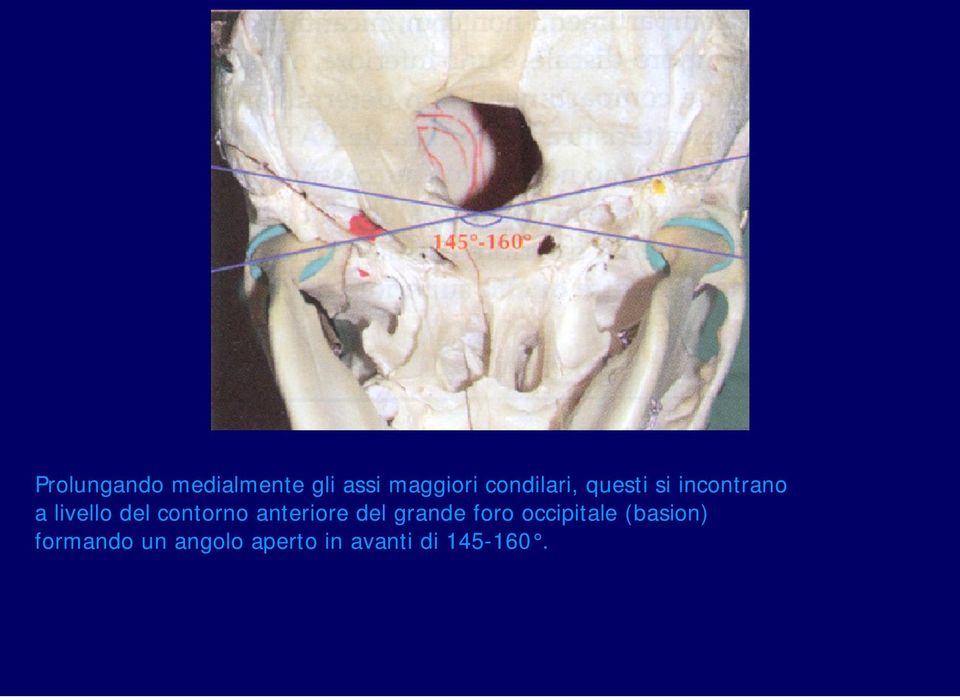 contorno anteriore del grande foro occipitale