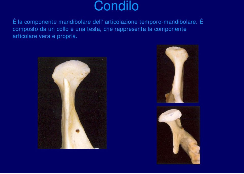 È composto da un collo e una testa, che