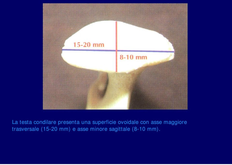 maggiore trasversale (15-20 mm)