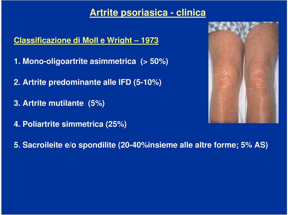 Artrite predominante alle IFD (5-10%) 3. Artrite mutilante (5%) 4.