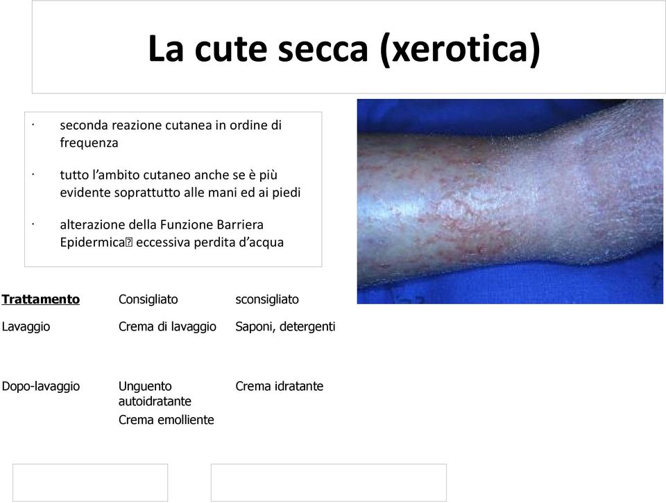 Barriera Epidermica eccessiva perdita d acqua Trattamento Consigliato sconsigliato Lavaggio