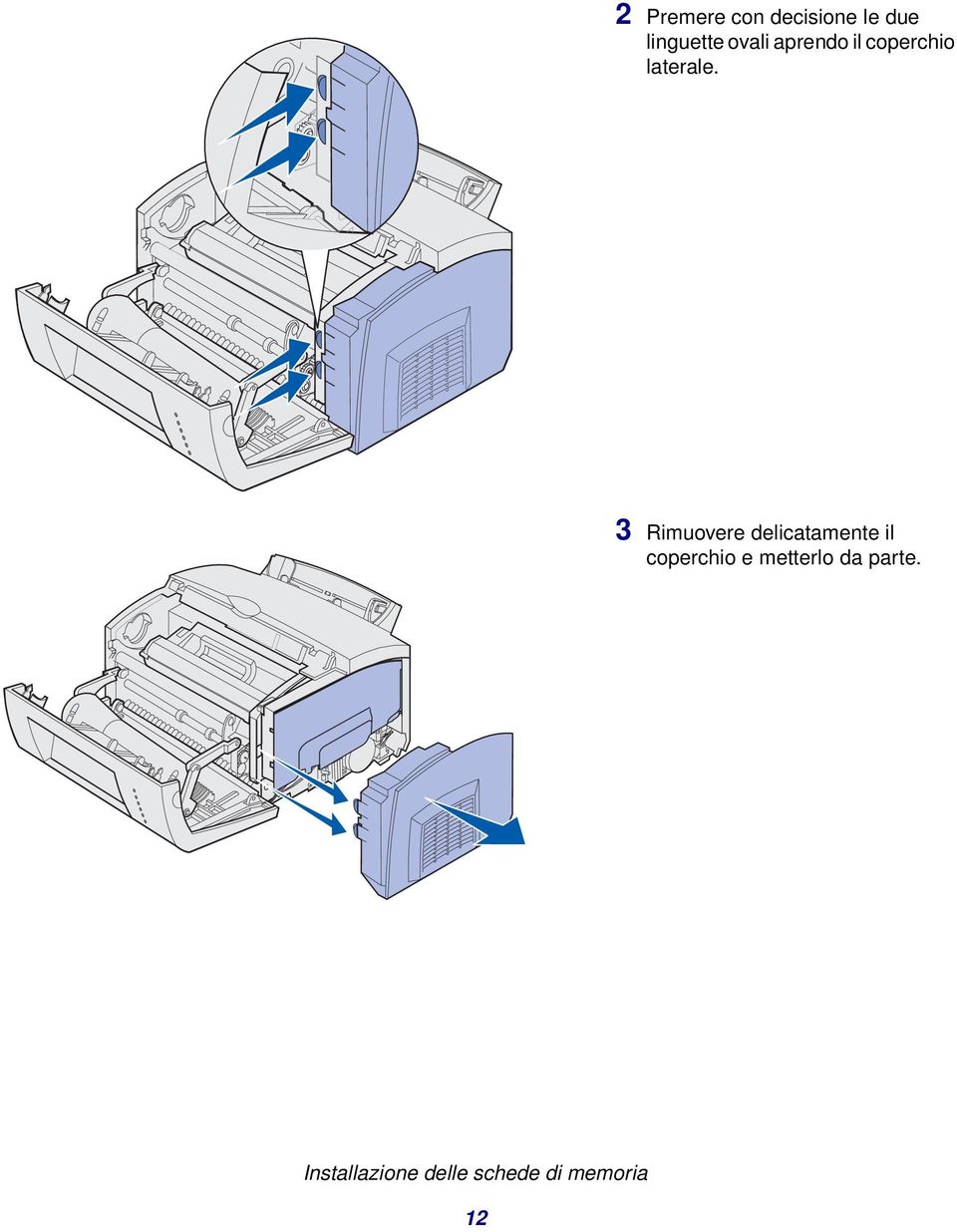 3 Rimuovere delicatamente il coperchio e