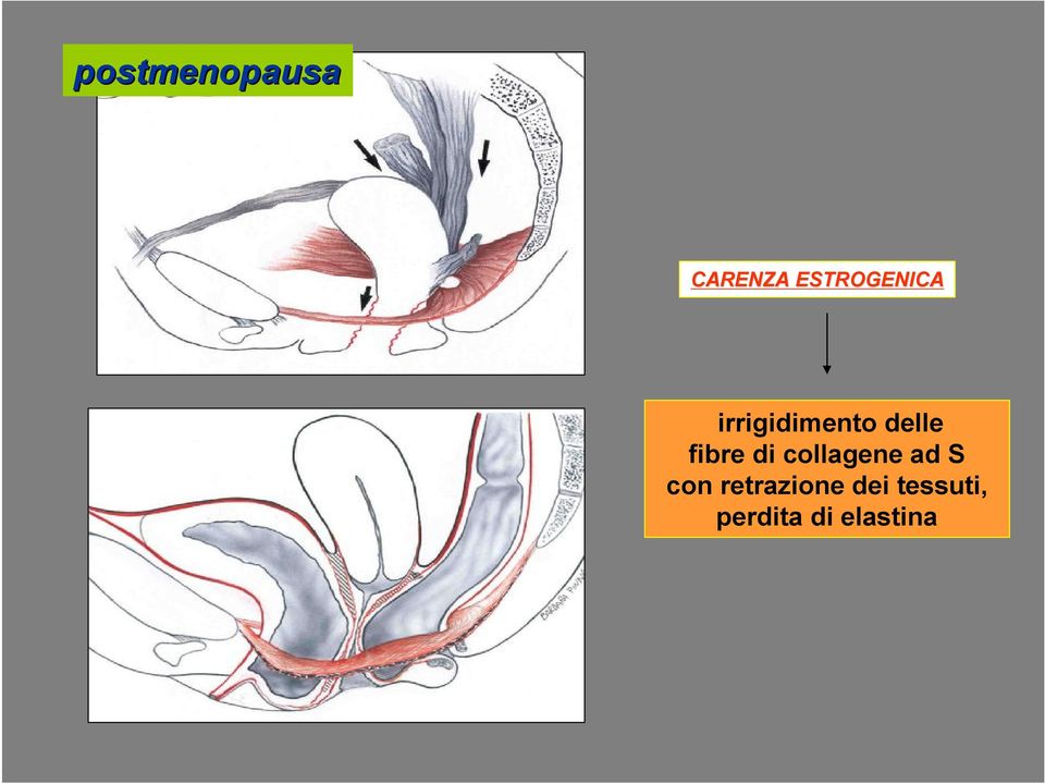 fibre di collagene ad S con