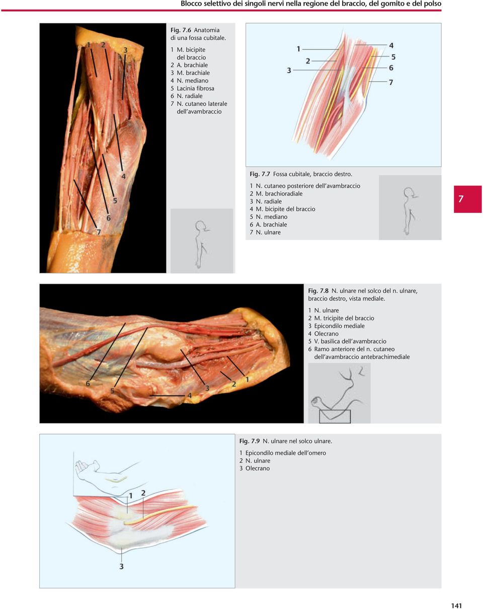 bicipite del braccio 5 N. mediano 6 A. brachiale 7 N. ulnare 7 Fig. 7.8 N. ulnare nel solco del n. ulnare, braccio destro, vista mediale. 1 N. ulnare 2 M.