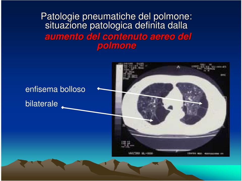 del contenuto aereo del