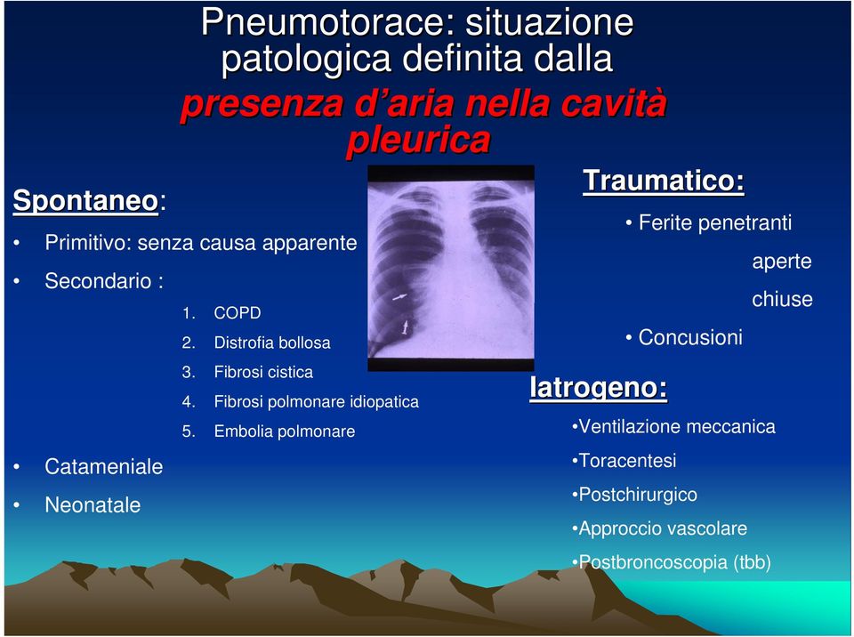 Fibrosi polmonare idiopatica 5.