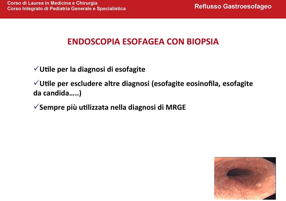 diagnosi (esofagite eosinofila, esofagite da