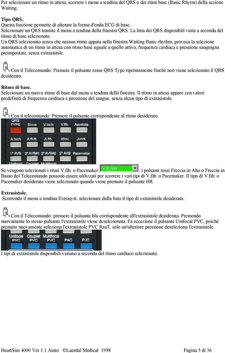 Un QRS selezionato senza che nessun ritmo appaia nella finestra Waiting Basic rhythm, provoca la selezione automatica di un ritmo in attesa con ritmo base uguale a quello attivo, frequenza cardiaca e