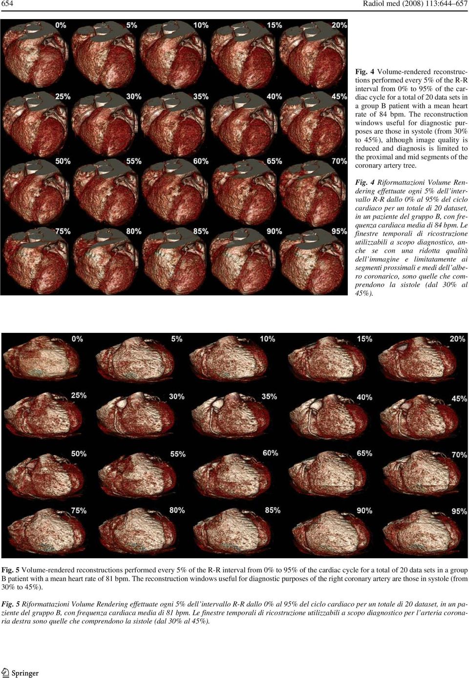 The reconstruction windows useful for diagnostic purposes are those in systole (from 30% to 45%), although image quality is reduced and diagnosis is limited to the proximal and mid segments of the