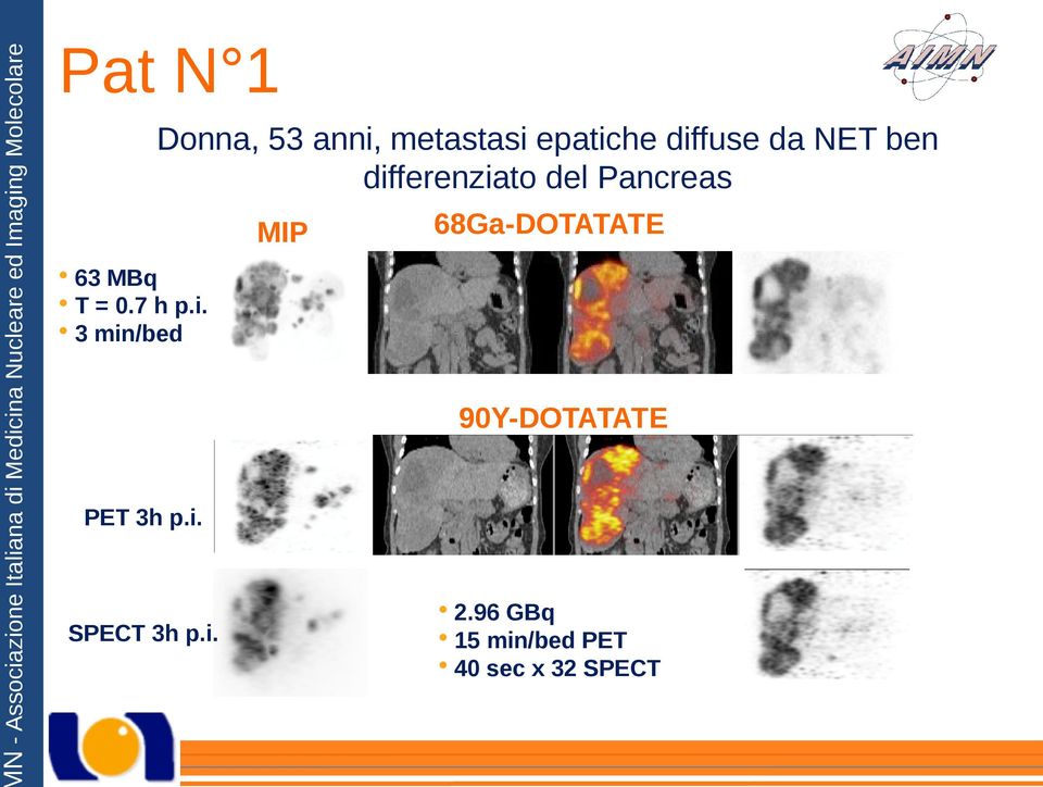 63 MBq T = 0.7 h p.i. 3 min/bed 90Y-DOTATATE PET 3h p.