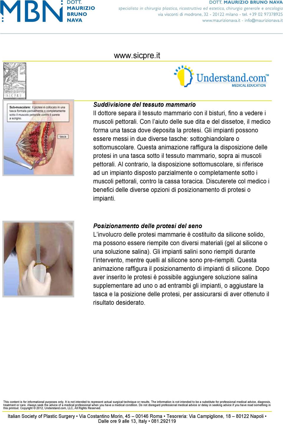 Questa animazione raffigura la disposizione delle protesi in una tasca sotto il tessuto mammario, sopra ai muscoli pettorali.