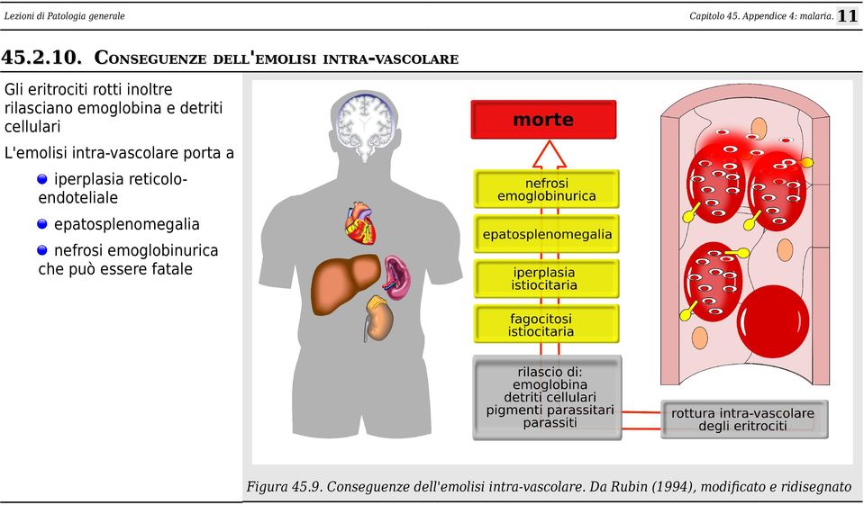 emoglobina e detriti cellulari L'emolisi intra-vascolare porta a iperplasia