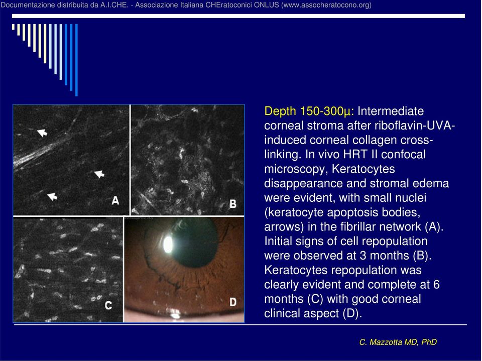 (keratocyte apoptosis bodies, arrows) in the fibrillar network (A).