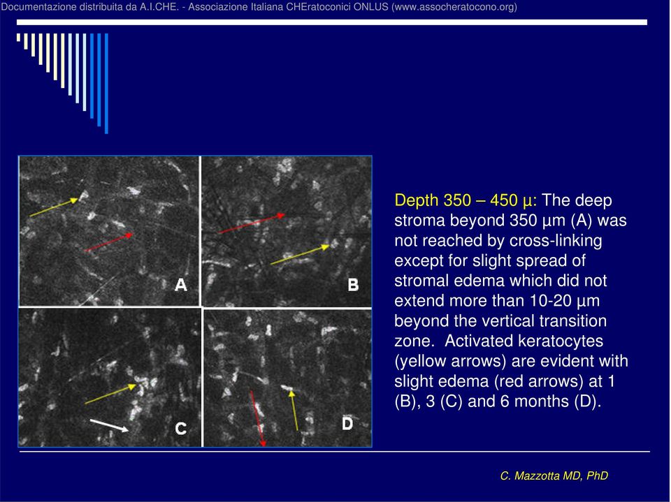 more than 10-20 µm beyond the vertical transition zone.