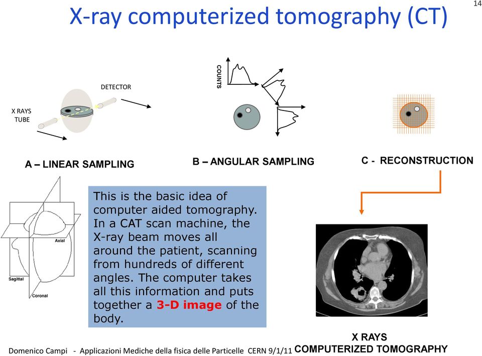In a CAT scan machine, the X-ray beam moves all around the patient, scanning from hundreds of different angles.