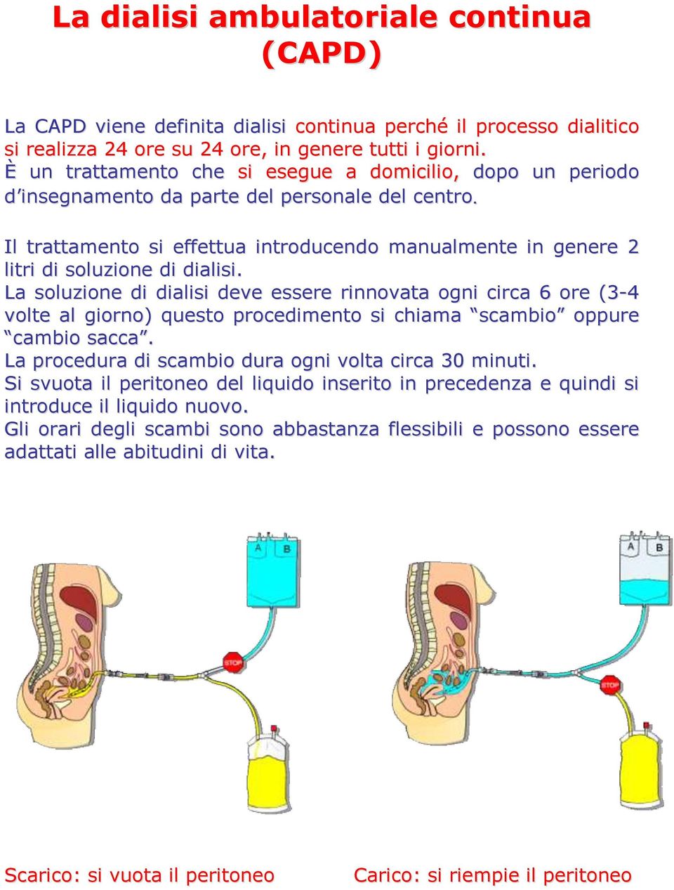 Il trattamento si effettua introducendo manualmente in genere 2 litri di soluzione di dialisi.