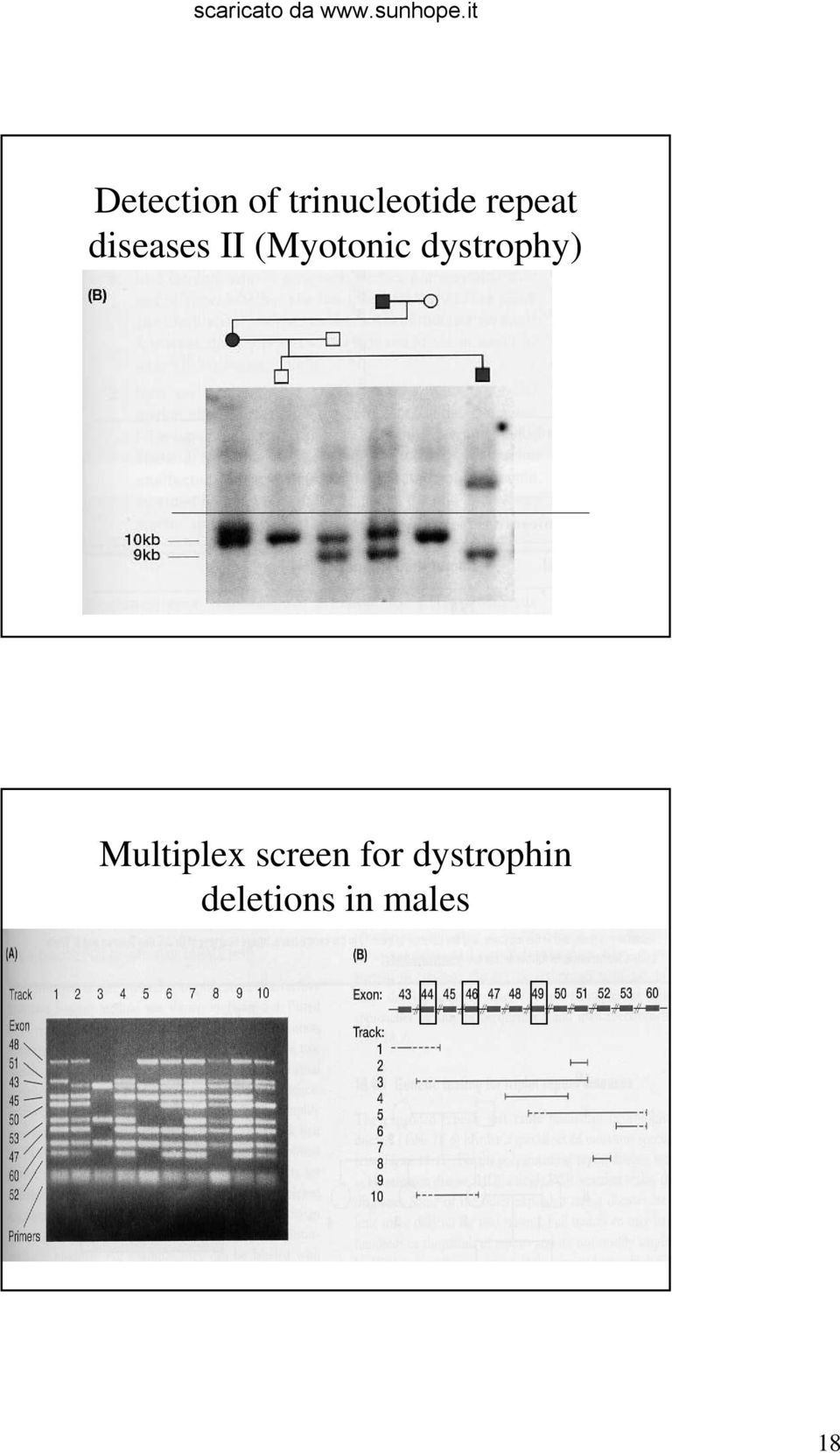 dystrophy) Multiplex screen